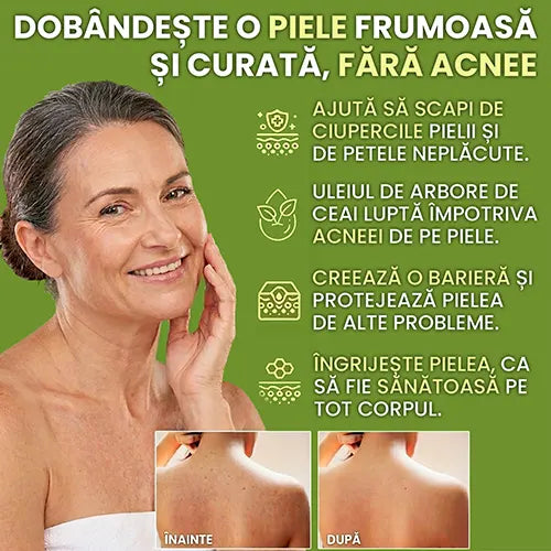 Sapun antifungic - Calmeaza iritatiile si reface bariera naturala a pielii