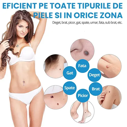 Aparat profesional pentru indepartarea Papiloamelor - potrivit pentru toate tipurile de piele