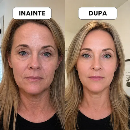 Crema anti-rid premium – ingrijire completa pentru o piele mai tanara si mai ferma