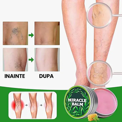 Crema naturista Anti-Durere – Reduce senzatia de picioare grele si obosite, inflamatia si disconfortul.