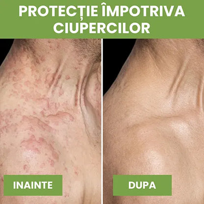 Sapun antifungic - Calmeaza iritatiile si reface bariera naturala a pielii