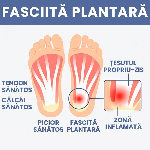 Suport Ortopedic pentru Calcai - Reduce Durerea de Fasciita Plantara