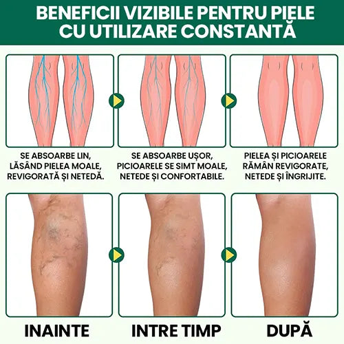 Crema naturista Anti-Durere – Reduce senzatia de picioare grele si obosite, inflamatia si disconfortul.