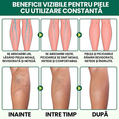 Crema naturista Anti-Durere – Reduce senzatia de picioare grele si obosite, inflamatia si disconfortul.