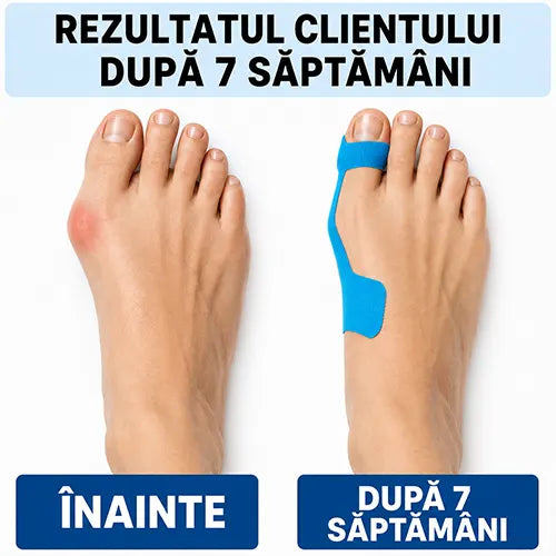 Bandaj terapeutic - Sprijin pentru monturi, confort zi de zi