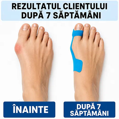 Bandaj terapeutic - Sprijin pentru monturi, confort zi de zi