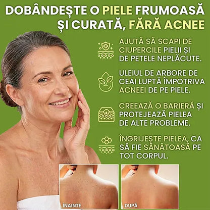 Sapun antifungic - Calmeaza iritatiile si reface bariera naturala a pielii