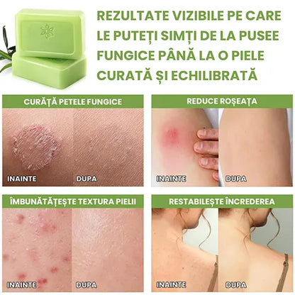 Sapun antifungic - Calmeaza iritatiile si reface bariera naturala a pielii