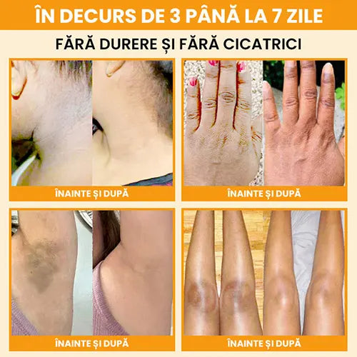 Gel exfoliant enzimatic cu portocale – pentru față și corp